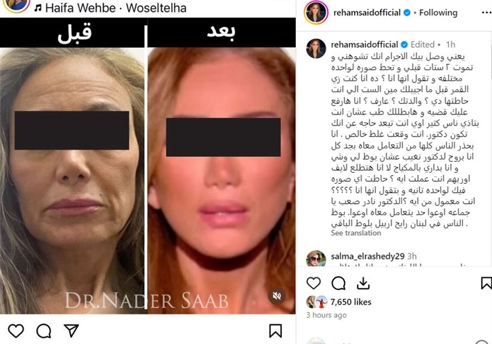 بالصور الإعلامية ريهام سعيد تصدم المتابعين قبل وبعد التجميل و تتهم طبيب تجميل بتشويهها 2 الإعلامية ريهام سعيد