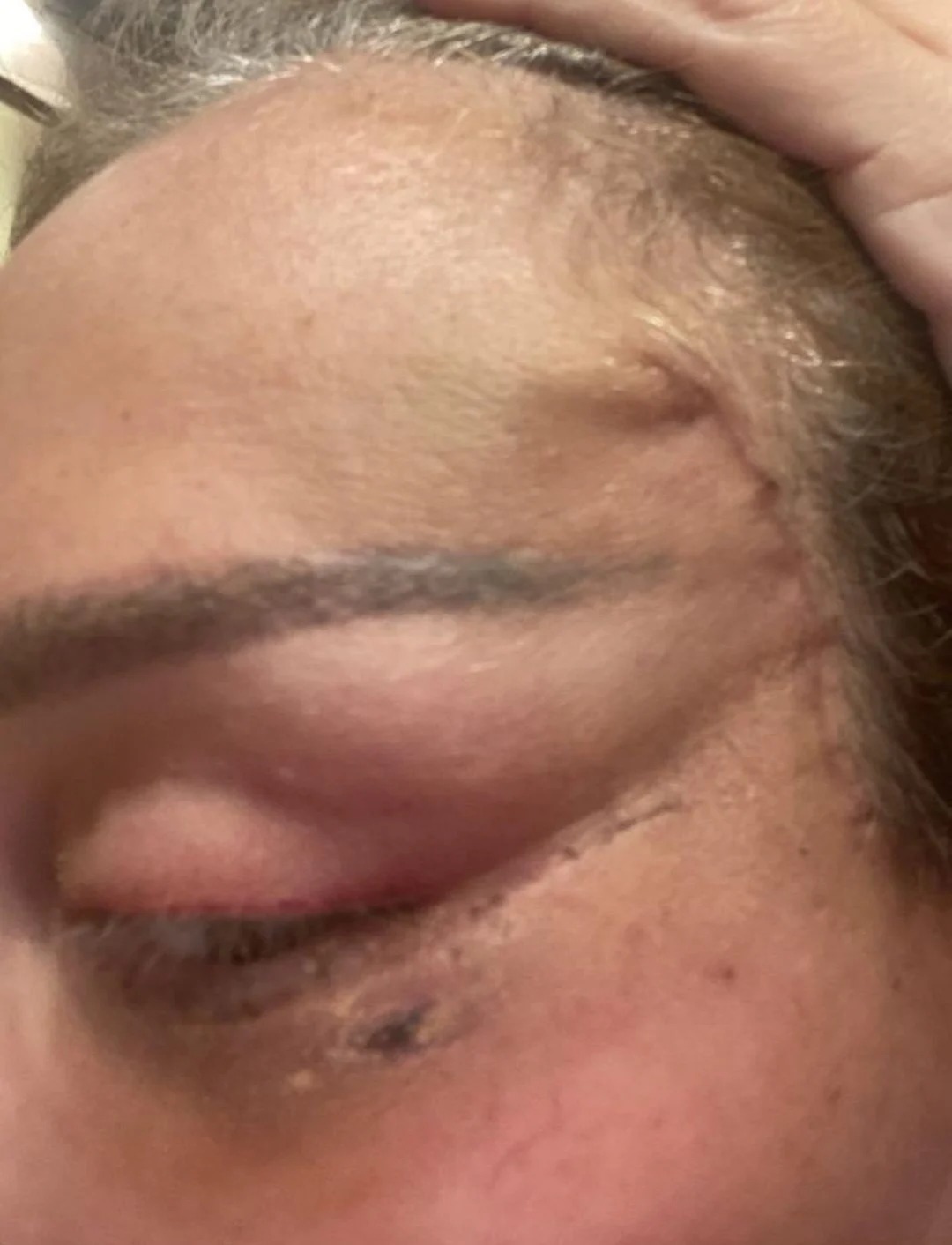 بالصور الإعلامية ريهام سعيد تصدم المتابعين قبل وبعد التجميل و تتهم طبيب تجميل بتشويهها 4 الإعلامية ريهام سعيد