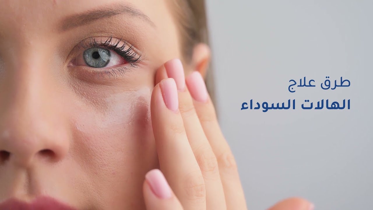 الهالات السوداء حول العينين تعرفي على طرق العلاج بالوصفات الطبيعية 3 علاج الهالات السوداء
