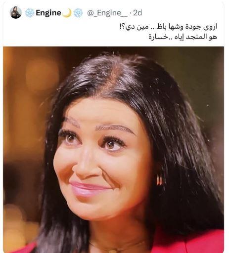 بعد تعليق جارح الفنانة أروى جودة تخرج عن صمتها وتكشف معاناتها مع هذا المرض 2 تغريدة الناشطة تسخر من الفنانة أروى جودة