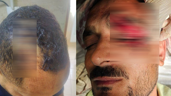 بالصور تفاصيل ما حدث باقباط عزبة يوسف ببنى سويف بعد مشاجرة ليلة قداس عيد القيامة 2 اشتباكات بين مسلمى واقباط فى عزبة يوسف ببنى سويف