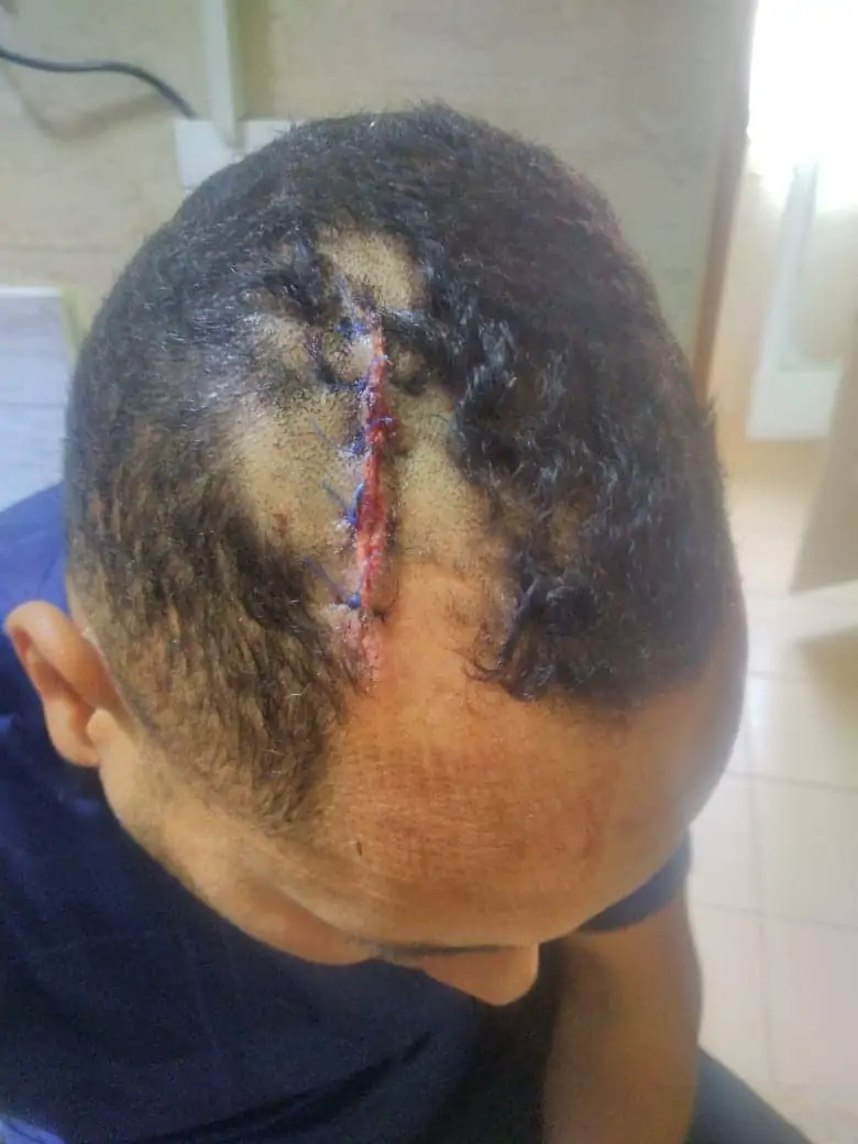 بالصور تفاصيل ما حدث باقباط عزبة يوسف ببنى سويف بعد مشاجرة ليلة قداس عيد القيامة 3 اشتباكات بين مسلمى واقباط فى عزبة يوسف ببنى سويف