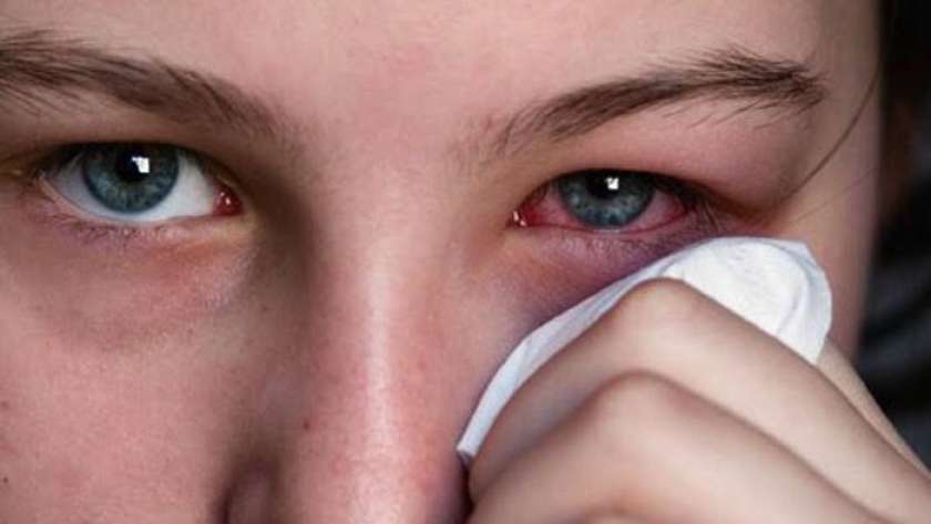 أعراض حساسية الربيع عند الأطفال نتيجة تغيرات جوية حادة 2 حساسية الربيع عند الأطفال