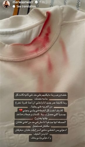 بالصور الفنانة مروة أنور تتعرض لحادث مؤلم خضة ورعب ربنا ما يكتبهم على حد 4 حادث الفنانة مروة أنور