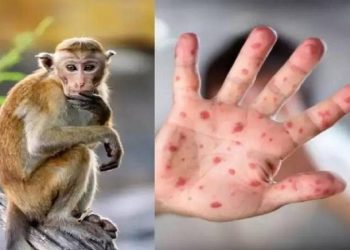حقيقة انتشار وباء جدري القرود في مصر مسئول الصحة يحسم الجدل