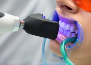 تحذير من مخاطر تبييض الأسنان يهدد صحتك في هذه الحالة
