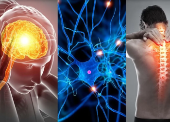 مرض التصلب المتعدد