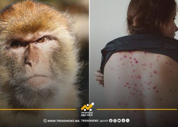 دولة تعلن أول حالة إصابة بجدري القرود سلالة خطيرة