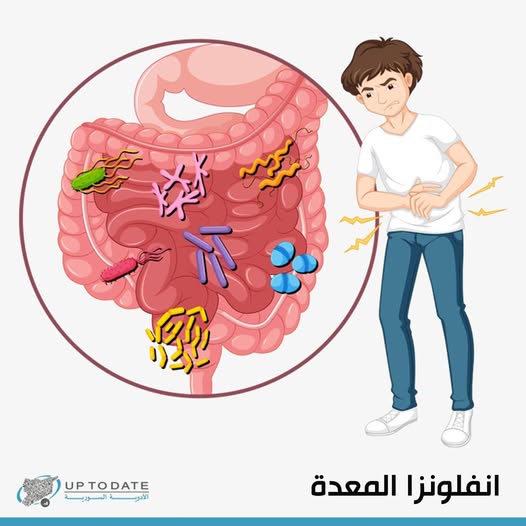 تحذيرات عالمية من تفشي إنفلونزا المعدة اكتشف الأسباب والأعراض ينتقل بـ اللمس 4 إنفلونزا المعدة