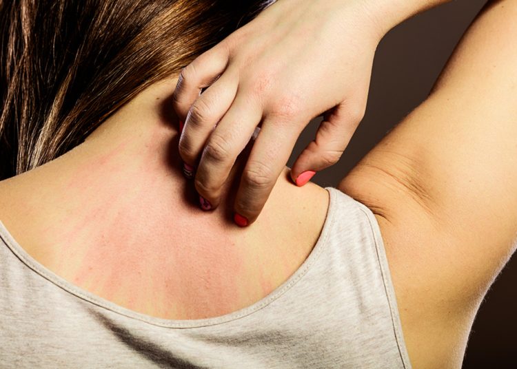 أعراض وأسباب الحزام الناري مرض صامت يهدد كبار السن اعرف طرق الوقاية 1 261 687 073740 62