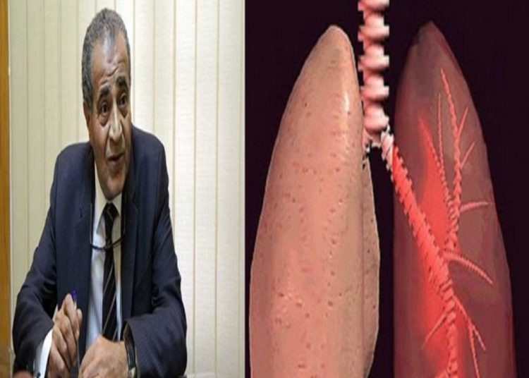 اعرف كيفية الوقاية من سرطان الرئة بعد إصابة وزير التموين السابق 1 الوقاية من سرطان الرئة