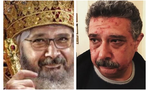 كيف غير الفنان ماجد الكدواني جلده 3 كيف غير الفنان ماجد الكدواني جلده
