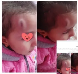 التعدي على طفلة بالحجارة بسبب تناولها الطعام في نهار رمضان ومارسيل والدتها تستغيث 3 حادث التعدي على طفلة