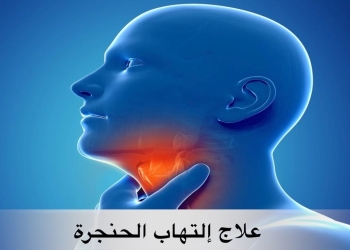 التهاب الحنجرة