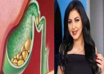 دكتور يوضح الفرق بين التهاب المرارة وانفجارها تسبب في وفاة الفنانة ايناس النجار 9 التهاب المرارة