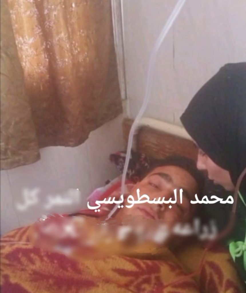 اول صور لواقعة طنطا عامل السيرك تعرض للإصابة وحقيقة أكل الأسد لذراعه 3 عامل السيرك المصاب