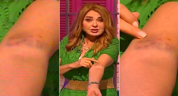 كنت مباركة من الرب مادلين طبر تروي لأول مرة عن إصابتها بعضة أسد 1 مادلين طبر
