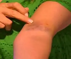 كنت مباركة من الرب مادلين طبر تروي لأول مرة عن إصابتها بعضة أسد 2 مادلين طبر