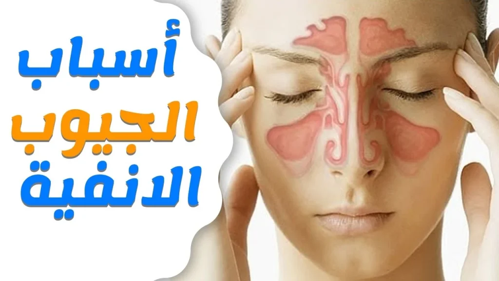 نصائح للمرضى الذين يعانون من مشاكل الجيوب الأنفية للحماية من التقلبات الجوية 4 نصائح لمرضى الجيوب الأنفية