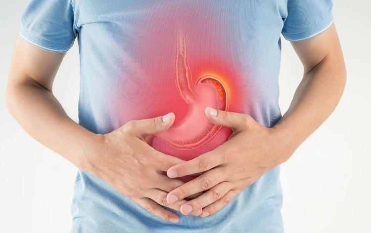 متى يصبح التهاب المعدة سرطانًا اعرف أعراضه وأسبابه وطرق علاجه 1 التهاب المعدة