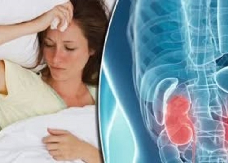 ازاى تتسلل المشروبات الغازية إلى كليتيك بعد إصابة شخص بأكثر من 30 حصوة كلوية 1 خطر المشروبات الغازية على الكلي