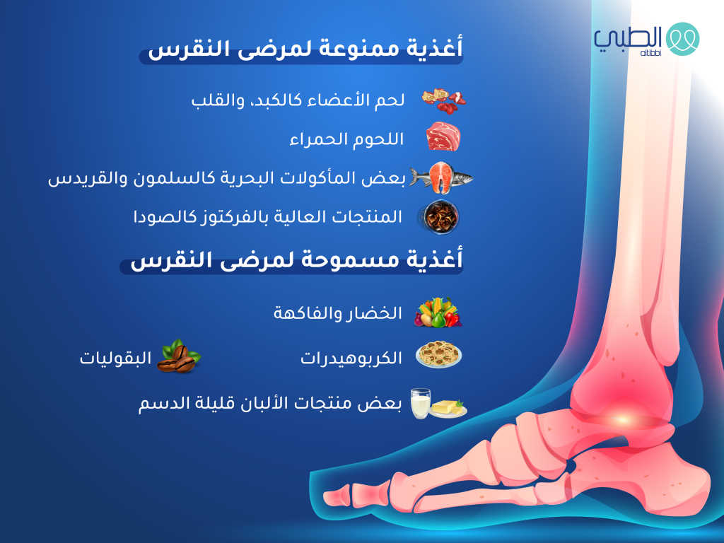 مرض النقرس هؤلاء الأشخاص الأكثر المعرضين للإصابة 3 مرض النقرس