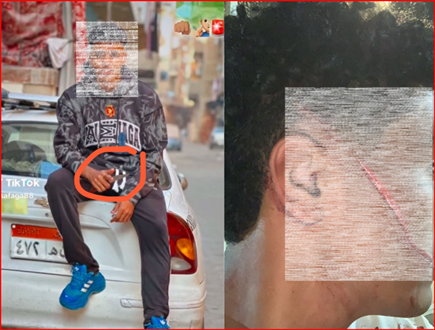 بالصور واقعة مأساوية بمنطقة روض الفرج مأساة عمار مستمرة ما زال يعاني من مرار الحادث 2 واقعة مأساوية بمنطقة روض الفرج