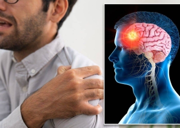 علامات غير متوقعة تكشف ورم المخ