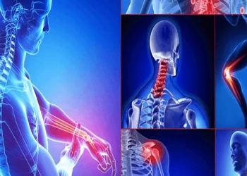 التهاب المفاصل نوع من النبات يقضي على الآلام ايه الحكاية 10 التهاب المفاصل