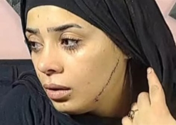 عروس مصر القديمة تكشف لحظات الرعب بعد تمزيـق وجهها هندمك عليها وهحبسك 8 عروس مصر القديمة