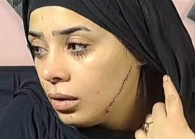 عروس مصر القديمة تكشف لحظات الرعب بعد تمزيـق وجهها هندمك عليها وهحبسك 1 عروس مصر القديمة