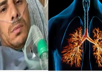 إصابة محمد زيدان بالعدوى الفيروسية التنفسية