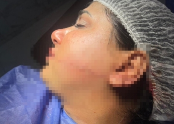 تعليق سمر ضحية الاعتداء من خطيبها ياريته قتلني ومشوهش وشي 12 سمر ضحية الاعتداء من خطيبها