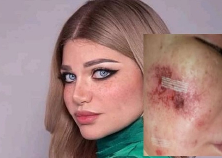 معلومات عن المرض الذي أصاب ياسمين الخطيب إليك تفاصيل توضيح الأطباء 1 المرض الذي أصاب ياسمين الخطيب