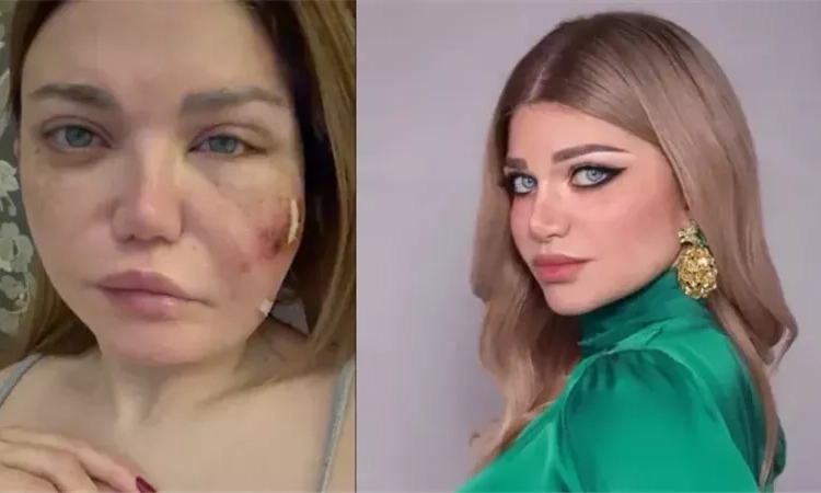 بالصور ياسمين الخطيب تكشف عن العدوى التي اصابتها وتسببت في إيقاف برنامجها وماهو هذا المرض الصادم 1 ياسمين الخطيب تكشف عن العدوى التي اصابتها