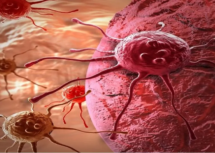 العثور على وثيقة سرية لعلاج السرطان مخبأة بامريكا منذ 60 سنه تثير الجدل العارم 1 وثيقة سرية لعلاج السرطان