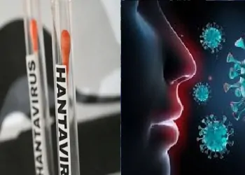 "هانتا"